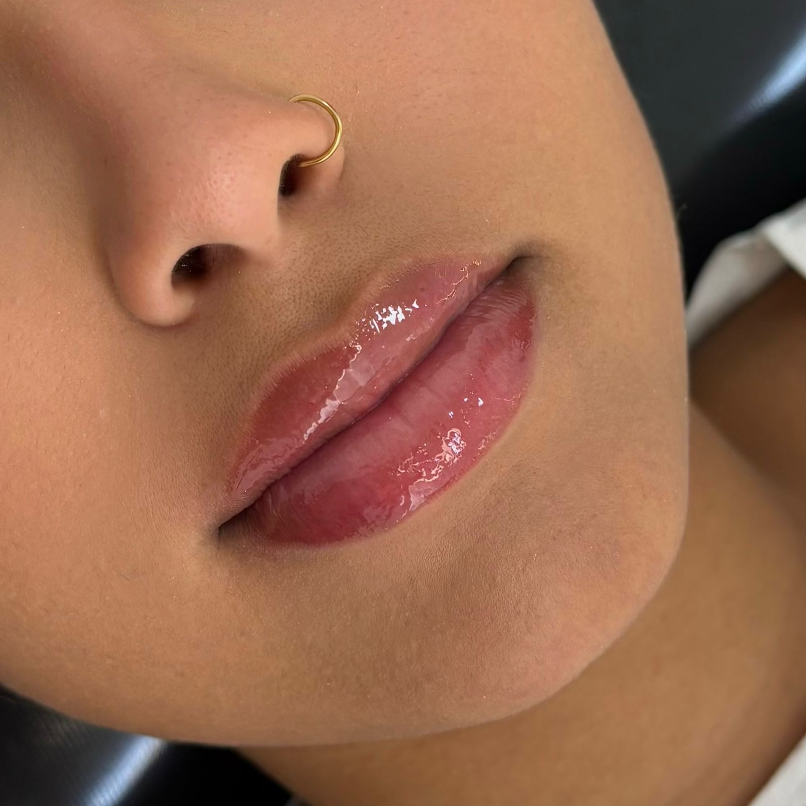 Foto do procedimento de Nutrigloss
